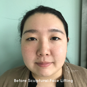 No Botox no injections pre sculptural face lifting by Eva Lu | La Floraison Wellness